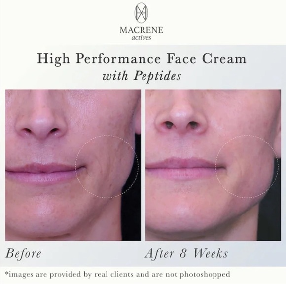 NIB Macrene Actives Moisturizing High Performing Face Cream with Peptides - Picture 12 of 13